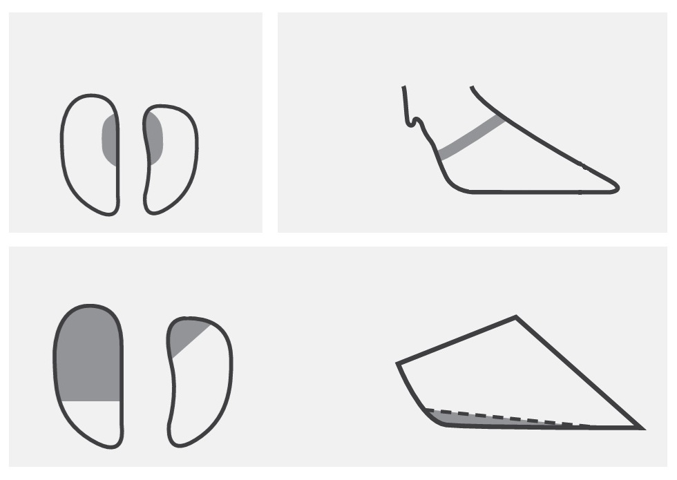 Fundamenty biomechaniki i Złoty Standard: Metoda Holenderska (5 Kroków) w nowoczesnej oborze